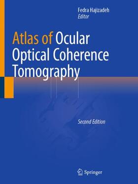 Hajizadeh |  Atlas of Ocular Optical Coherence Tomography | Buch |  Sack Fachmedien