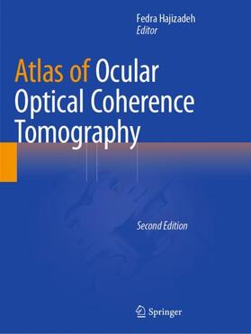 Hajizadeh |  Atlas of Ocular Optical Coherence Tomography | Buch |  Sack Fachmedien