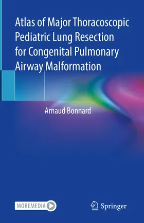 Bonnard |  Atlas of Major Thoracoscopic Pediatric Lung Resection for Congenital Pulmonary Airway Malformation | eBook | Sack Fachmedien