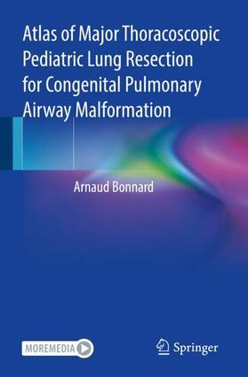 Bonnard |  Atlas of Major Thoracoscopic Pediatric Lung Resection for Congenital Pulmonary Airway Malformation | Buch |  Sack Fachmedien