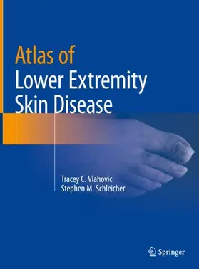 Schleicher / Vlahovic |  Atlas of Lower Extremity Skin Disease | Buch |  Sack Fachmedien