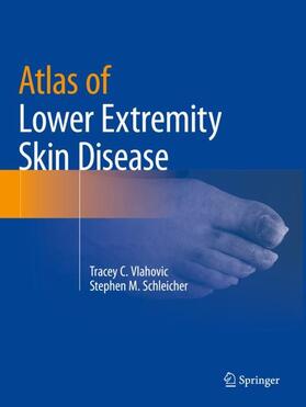 Schleicher / Vlahovic | Atlas of Lower Extremity Skin Disease | Buch | 978-3-031-07952-8 | sack.de