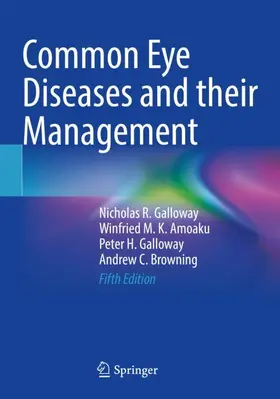 Galloway / Browning / Amoaku |  Common Eye Diseases and their Management | Buch |  Sack Fachmedien