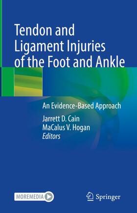 Hogan / Cain |  Tendon and Ligament Injuries of the Foot and Ankle | Buch |  Sack Fachmedien