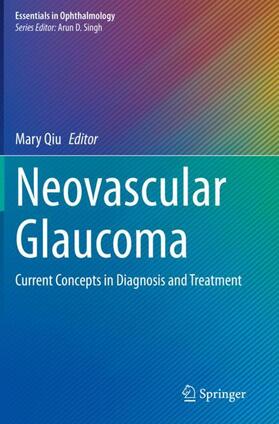 Qiu |  Neovascular Glaucoma | Buch |  Sack Fachmedien