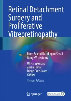 Spandau / Ruiz-Casas / Tomic |  Retinal Detachment Surgery and Proliferative Vitreoretinopathy | Buch |  Sack Fachmedien