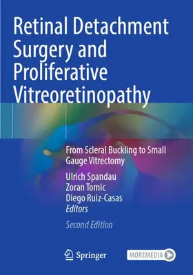 Spandau / Ruiz-Casas / Tomic |  Retinal Detachment Surgery and Proliferative Vitreoretinopathy | Buch |  Sack Fachmedien