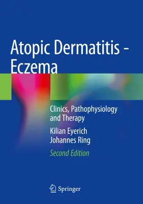 Ring / Eyerich |  Atopic Dermatitis - Eczema | Buch |  Sack Fachmedien