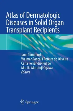 Tomimori / Ogawa / Oliveira |  Atlas of Dermatologic Diseases in Solid Organ Transplant Recipients | Buch |  Sack Fachmedien