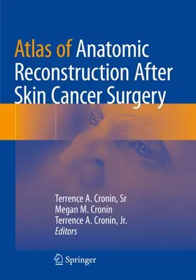 Cronin / Cronin, Sr / Cronin, Jr. |  Atlas of Anatomic Reconstruction After Skin Cancer Surgery | Buch |  Sack Fachmedien