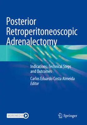 Eduardo Costa Almeida |  Posterior Retroperitoneoscopic Adrenalectomy | Buch |  Sack Fachmedien