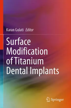 Gulati |  Surface Modification of Titanium Dental Implants | Buch |  Sack Fachmedien