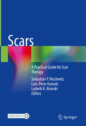 Nischwitz / Kamolz / Branski |  Scars | eBook | Sack Fachmedien