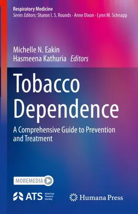 Kathuria / Eakin |  Tobacco Dependence | Buch |  Sack Fachmedien