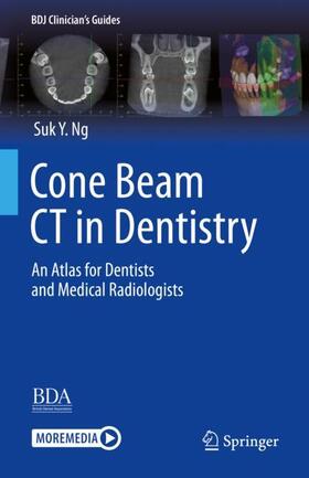 Ng |  Cone Beam CT in Dentistry | Buch |  Sack Fachmedien