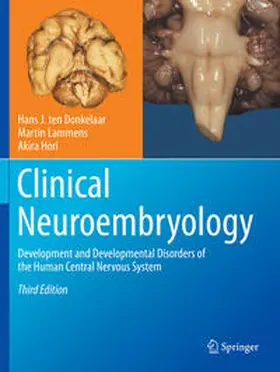 Hori / ten Donkelaar / Lammens |  Clinical Neuroembryology | Buch |  Sack Fachmedien