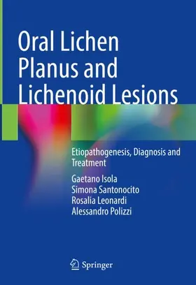 Isola / Polizzi / Santonocito |  Oral Lichen Planus and Lichenoid Lesions | Buch |  Sack Fachmedien