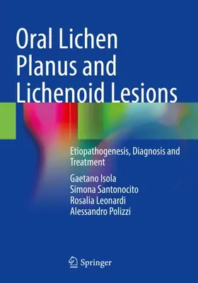 Isola / Polizzi / Santonocito |  Oral Lichen Planus and Lichenoid Lesions | Buch |  Sack Fachmedien