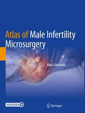 Goldstein |  Atlas of Male Infertility Microsurgery | Buch |  Sack Fachmedien