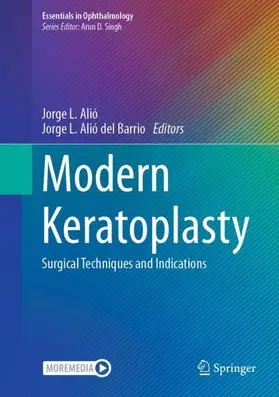 del Barrio / Alió |  Modern Keratoplasty | Buch |  Sack Fachmedien