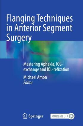 Amon |  Flanging Techniques in Anterior Segment Surgery | Buch |  Sack Fachmedien