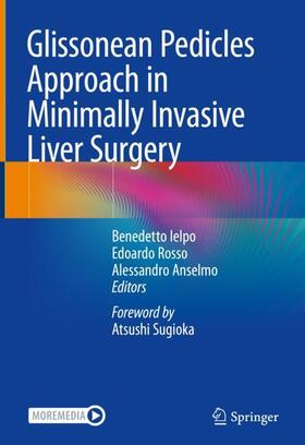 Ielpo / Rosso / Anselmo |  Glissonean Pedicles Approach in Minimally Invasive Liver Surgery | Buch |  Sack Fachmedien