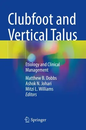 Dobbs / Williams / Johari |  Clubfoot and Vertical Talus | Buch |  Sack Fachmedien