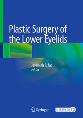 Tao |  Plastic Surgery of the Lower Eyelids | Buch |  Sack Fachmedien