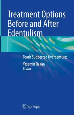 Özkan |  Treatment Options Before and After Edentulism | Buch |  Sack Fachmedien