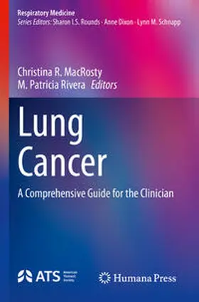 Rivera / MacRosty |  Lung Cancer | Buch |  Sack Fachmedien