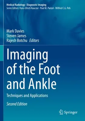 Davies / Botchu / James |  Imaging of the Foot and Ankle | Buch |  Sack Fachmedien