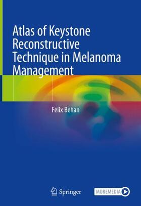 Behan |  Atlas of Keystone Reconstructive Technique in Melanoma Management | Buch |  Sack Fachmedien