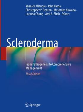 Allanore / Varga / Shah |  Scleroderma | Buch |  Sack Fachmedien