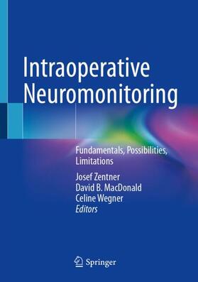 Zentner / Wegner / MacDonald |  Intraoperative Neuromonitoring | Buch |  Sack Fachmedien