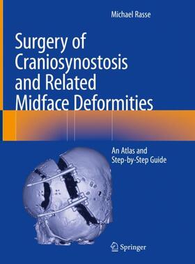 Rasse |  Surgery of Craniosynostosis and Related Midface Deformities | Buch |  Sack Fachmedien