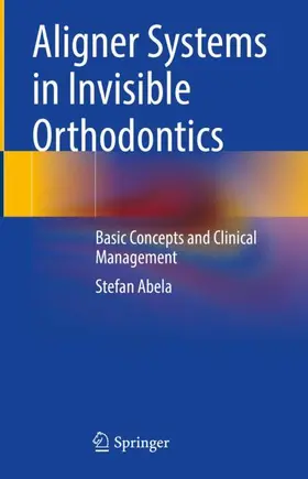 Abela |  Aligner Systems in Invisible Orthodontics | Buch |  Sack Fachmedien