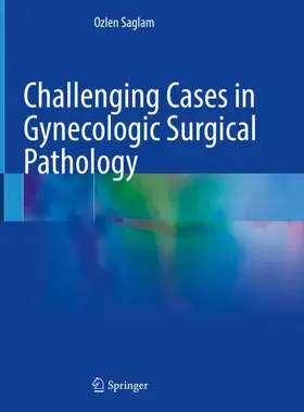 Saglam |  Challenging Cases in Gynecologic Surgical Pathology | Buch |  Sack Fachmedien