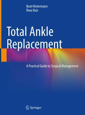 Ruiz / Hintermann |  Total Ankle Replacement | Buch |  Sack Fachmedien