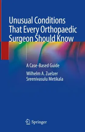 Metikala / Zuelzer |  Unusual Conditions That Every Orthopaedic Surgeon Should Know | Buch |  Sack Fachmedien