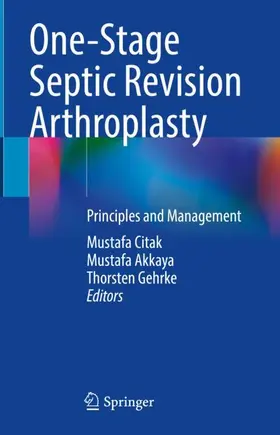 Citak / Gehrke / Akkaya |  One-Stage Septic Revision Arthroplasty | Buch |  Sack Fachmedien