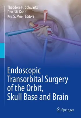 Schwartz / Moe / Kong |  Endoscopic Transorbital Surgery of the Orbit, Skull Base and Brain | Buch |  Sack Fachmedien