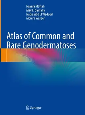 Moftah / Waseef / El Samahy |  Atlas of Common and Rare Genodermatoses | Buch |  Sack Fachmedien