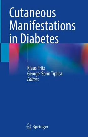 Tiplica / Fritz |  Cutaneous Manifestations in Diabetes | Buch |  Sack Fachmedien