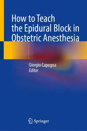 Capogna |  How to Teach the Epidural Block in Obstetric Anesthesia | Buch |  Sack Fachmedien