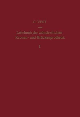 VEST |  Lehrbuch der Zahnärztlichen Kronen- und Brückenprothetik | Buch |  Sack Fachmedien