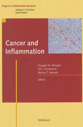 Morgan / Forssman / Nakada |  Cancer and Inflammation | eBook | Sack Fachmedien