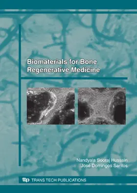 Sooraj Hussain / Santos |  Biomaterials for Bone, Regenerative Medicine | eBook | Sack Fachmedien