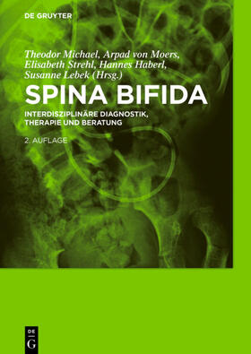 Michael / Moers / Strehl |  Spina bifida | Buch |  Sack Fachmedien