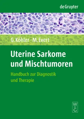 Köhler / Evert |  Uterine Sarkome und Mischtumoren | eBook | Sack Fachmedien