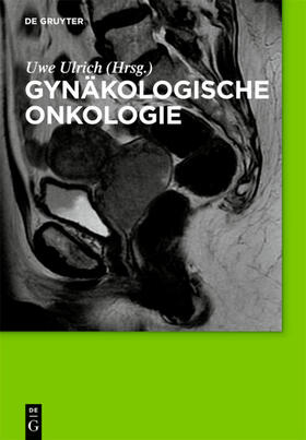 Ulrich |  Gynäkologische Onkologie | eBook | Sack Fachmedien